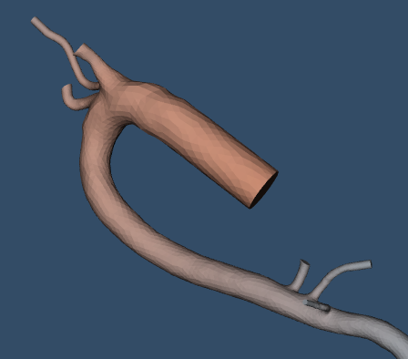 Aorto-Femoral