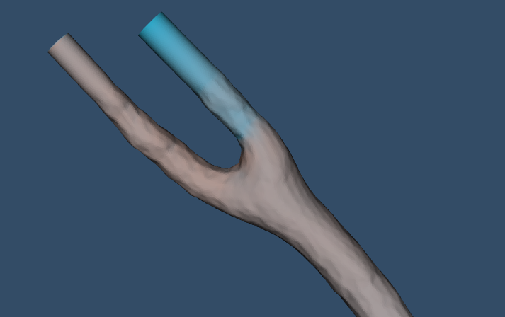 Carotid Artery