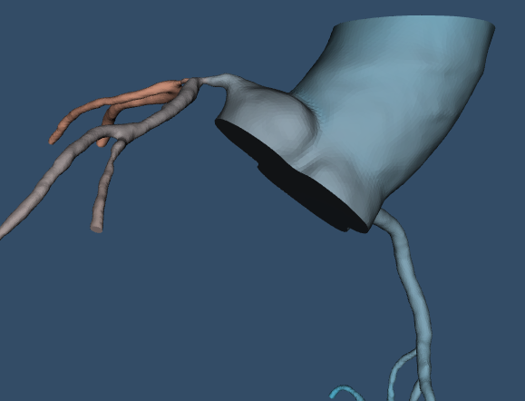 Coronary