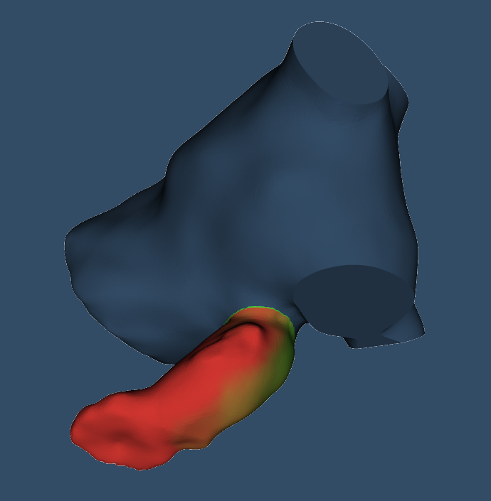 Left Atrium Appendage Simulator