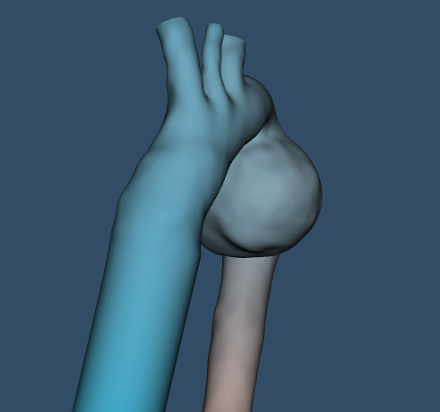 Thoracic Aorta
